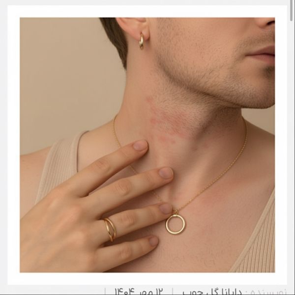  انواع حساسیت‌ها به فلزات و راهکارهای مقابله با آن